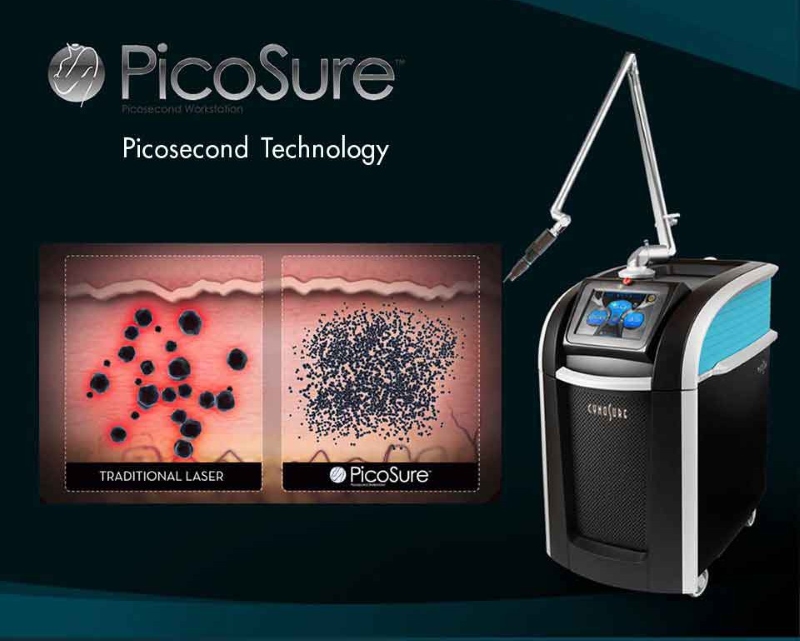 Lý do chọn Máy Spa Asia cho sửa chữa máy Picosure